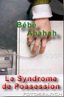 ahahah syndrome
